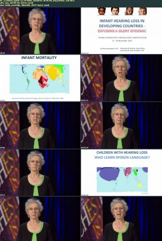 Coursera – Deafness in the 21st Century